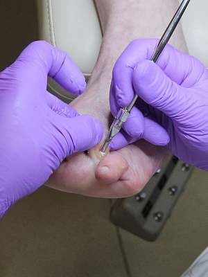 Основы ПОДОЛОГИИ 7 дней 